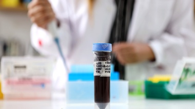 Detectan beneficios del cannabis en enfermedades de origen hipertensivo