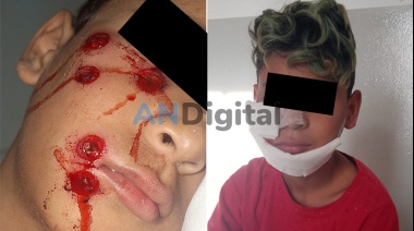 Denuncian que un nene fue baleado durante brutal represión policial en comedor de Quilmes