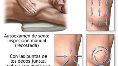 Cáncer de mama: el simple control que puede salvarte la vida y que pocas mujeres hacen