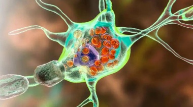 Enfermedad de Fabry: una afección poco frecuente que debe ser diagnosticada y tratada a tiempo