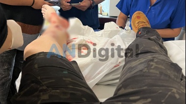 Un perro Pitbull le destrozó la pierna a una oficial durante un allanamiento en Lanús