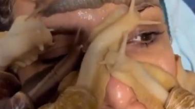 Una mujer que usa caracoles en la cara como tratamiento antienvejecimiento