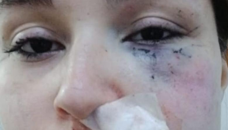 Solano: Buscan a un joven acusado de atacar a su pareja y herir a su hija