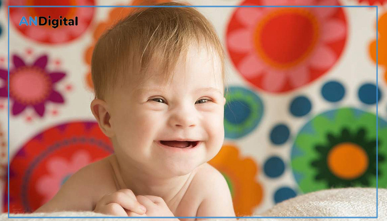 Día Mundial del Síndrome de Down: “Los derechos no tienen cromosomas”