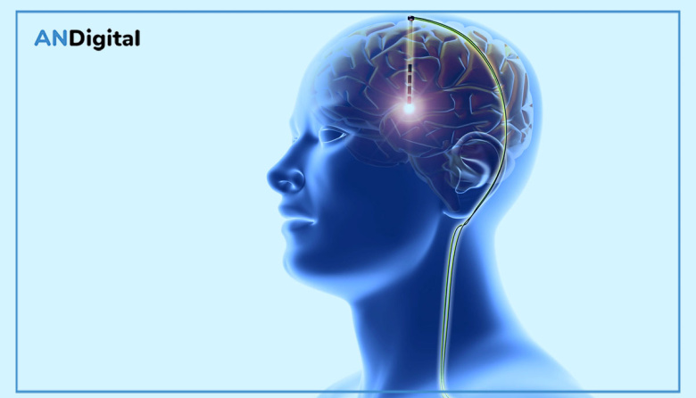 Estimulación cerebral profunda: una cirugía que puede mejorar la calidad de vida en pacientes con Parkinson