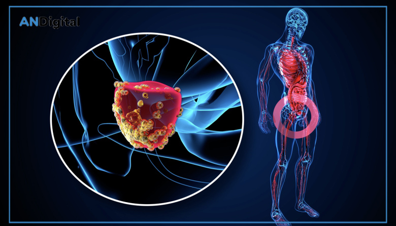 Cáncer de próstata: controles a tiempo, diagnóstico más preciso y decisiones mejor orientadas