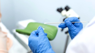 Cáncer de cuello uterino: una enfermedad que podría erradicarse