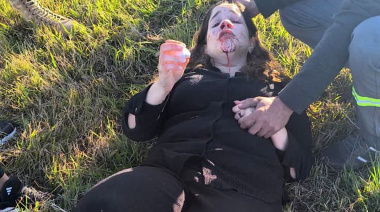 Se accidentó la diputada Rocío Bonacci cuando viajaba hacia el Congreso