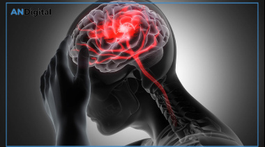 ¿Por qué cada vez más personas menores de 55 años sufren un ACV?