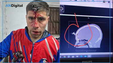 Pelearon en un partido de fútbol en Berazategui y uno le lavó una llave en la frente a otro