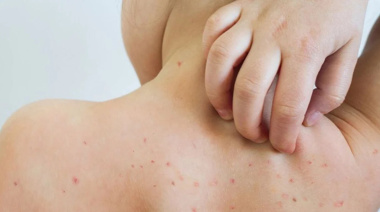 Sarampión: la familia que cruzó el país tuvo 98 contactos estrechos y buscan a otros 54