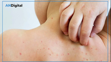 Sarampión: la familia que cruzó el país tuvo 98 contactos estrechos y buscan a otros 54