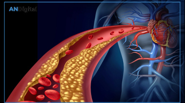 Colesterol: cuál es el riesgo silencioso que los análisis de rutina no detectan