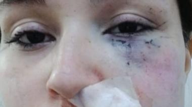 Solano: Buscan a un joven acusado de atacar a su pareja y herir a su hija