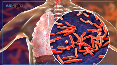 Argentina registra sostenido aumento de tuberculosis en el último lustro