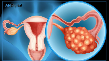 La ciencia cambió el foco: el cáncer de ovario podría originarse en las trompas de Falopio