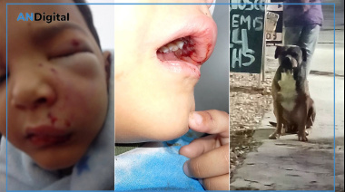 Un perro desfiguró a un nene de 5 años en San Vicente y denuncian que el hospital “minimizó” las heridas