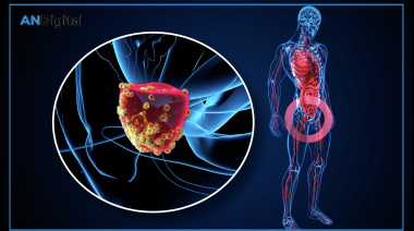 Cáncer de próstata: controles a tiempo, diagnóstico más preciso y decisiones mejor orientadas