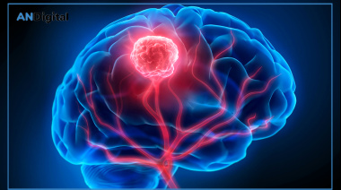 Glioblastoma: una enfermedad poco frecuente, agresiva y de enorme impacto