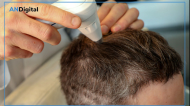 ¿Usar gorra te hace perder el pelo? ¿Padre pelado, hijo pelado?: caen mitos sobre la caída del cabello