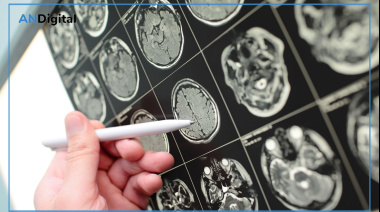 Tumores cerebrales: reconocieron a periodistas por su divulgación en ciencia y salud