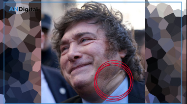 Qué le pasó a Javier Milei: apareció con un gran apósito en el cuello