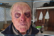 Tres delincuentes desfiguraron con un fierro a un hombre de 90 años para robarle
