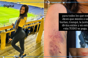 Agresión en La Bombonera: Valentina Salcedo señaló a gente ligada a Chanchi Riquelme