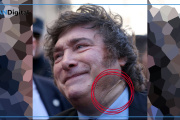 Qué le pasó a Javier Milei: apareció con un gran apósito en el cuello